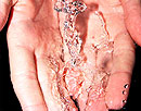 The Scale Invader inhibits lime scale build up and provides maintenance free hard water treatment